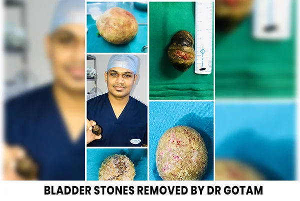 Dr. Gotam Pipara