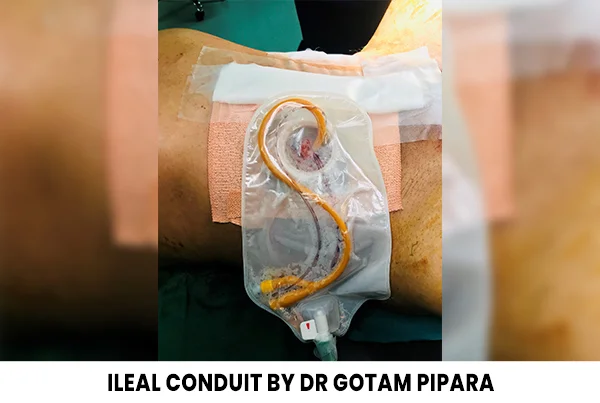 Dr. Gotam Pipara