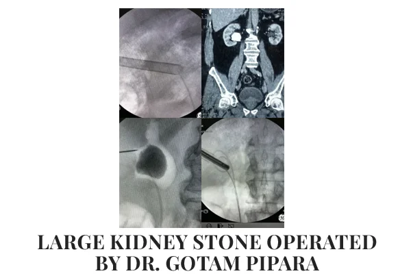 Dr. Gotam Pipara