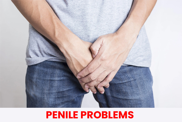 PENILE PROBLEMS