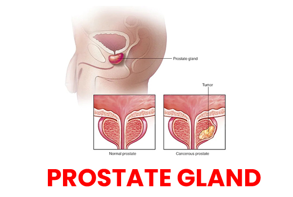 Prostate