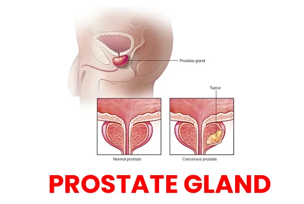 PROSTATE