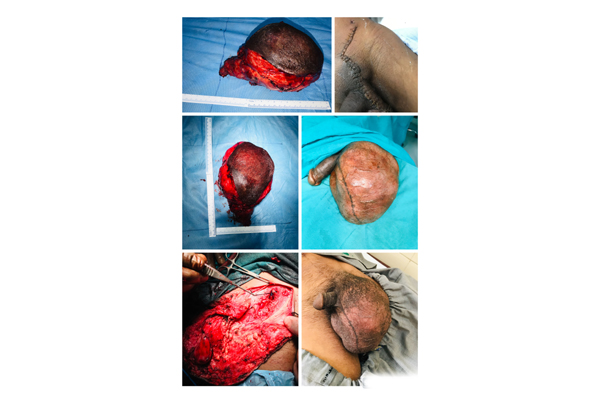 TESTIS
