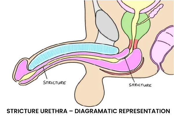 URETHRA