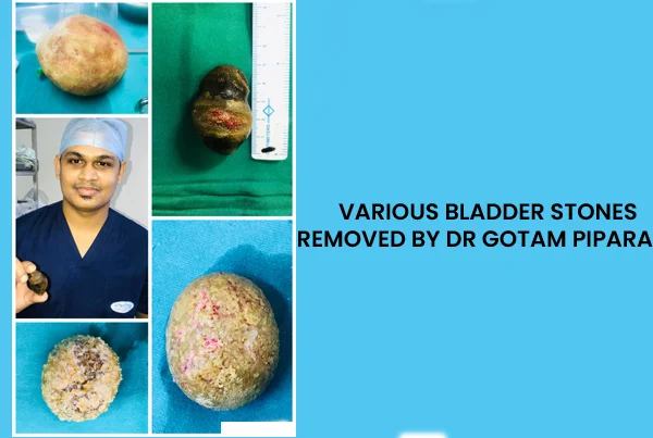 Urinary Bladder