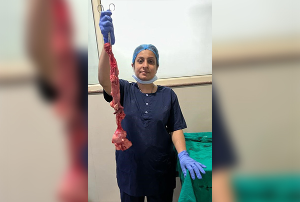 LAPAROSCOPIC HYSTERECTOMY